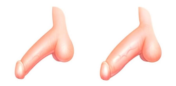 Members before and after increasing