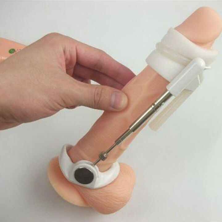 The extender will help increase the size of the penis without cream